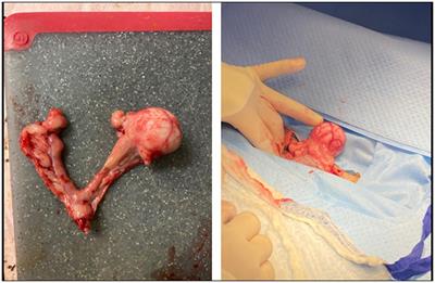 Case report: A case of oviductal and uterine leiomyosarcoma in an 11-year-old dog